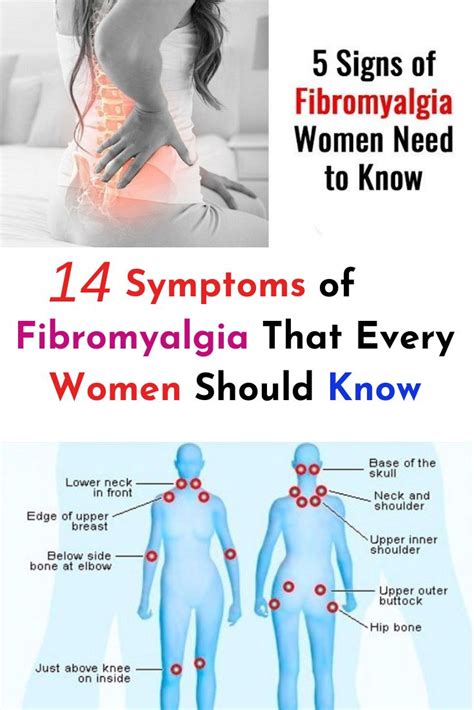 fibromyalgia symptoms in women